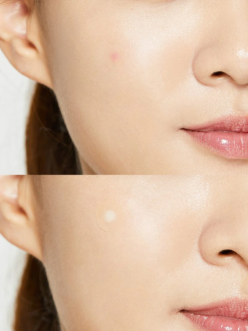 [COSRX] Set of 4 Acne Pimple Master Patch - Image 3