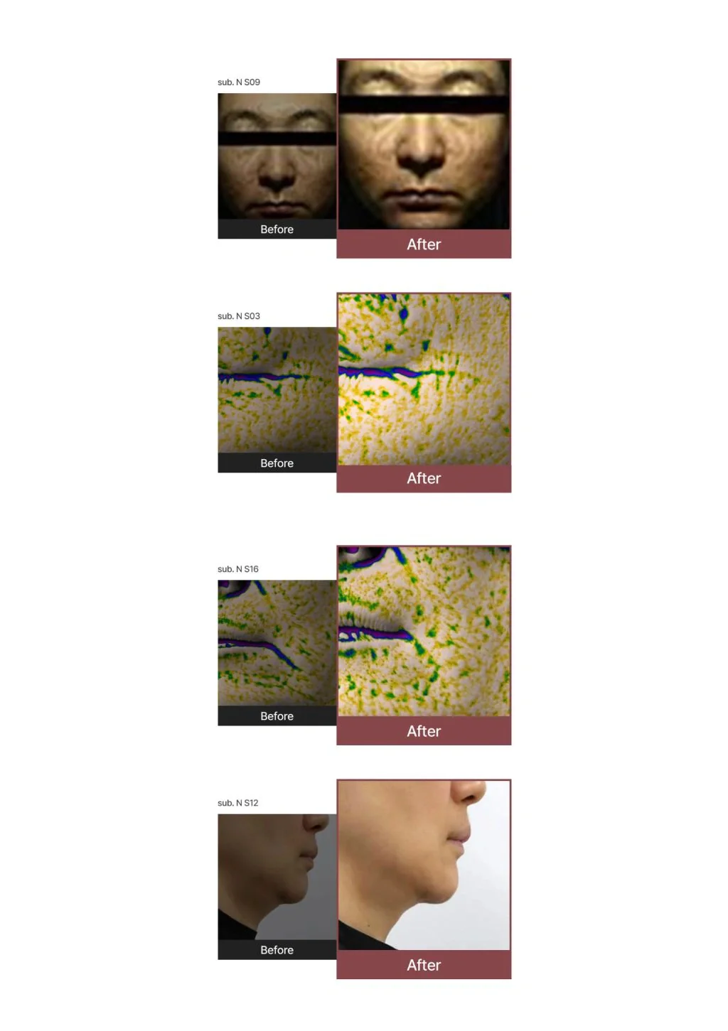 [AIDA] V-Collagen Power Lifting Mask  (1 Box = 4 Masks x 23.77g) - Image 10