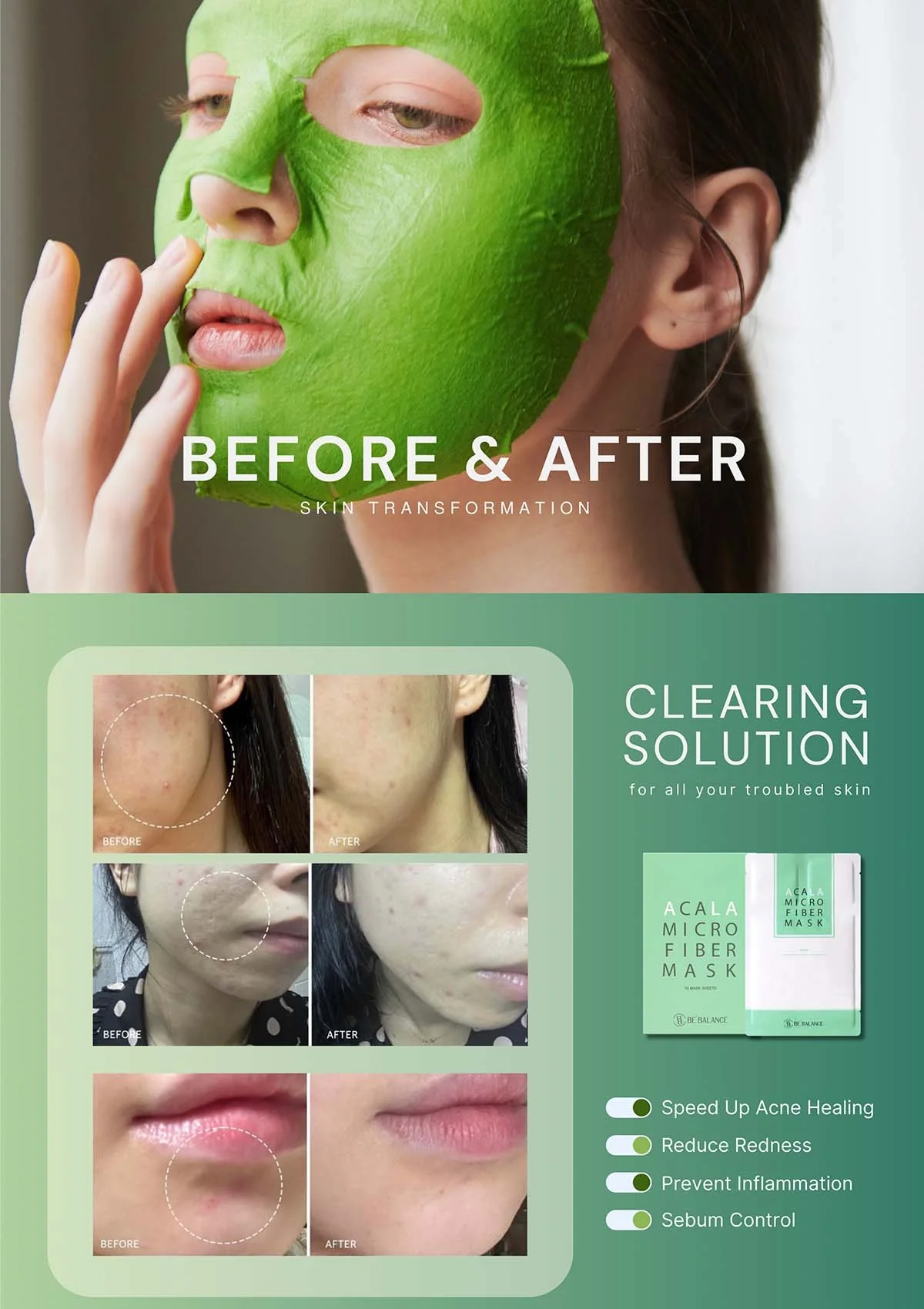 [BE'BALANCE] Acala Microfiber Mask (1 Box = 30g x 10 Masks) - Image 7