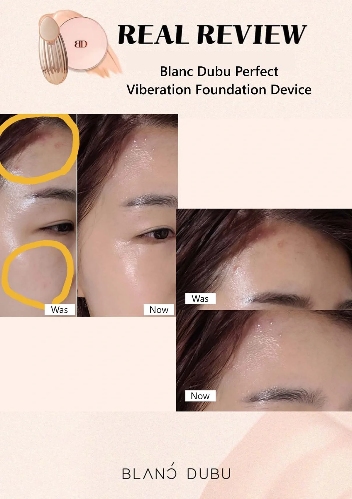 [BLANC DUBU] Vibration Foundation Device - Image 8