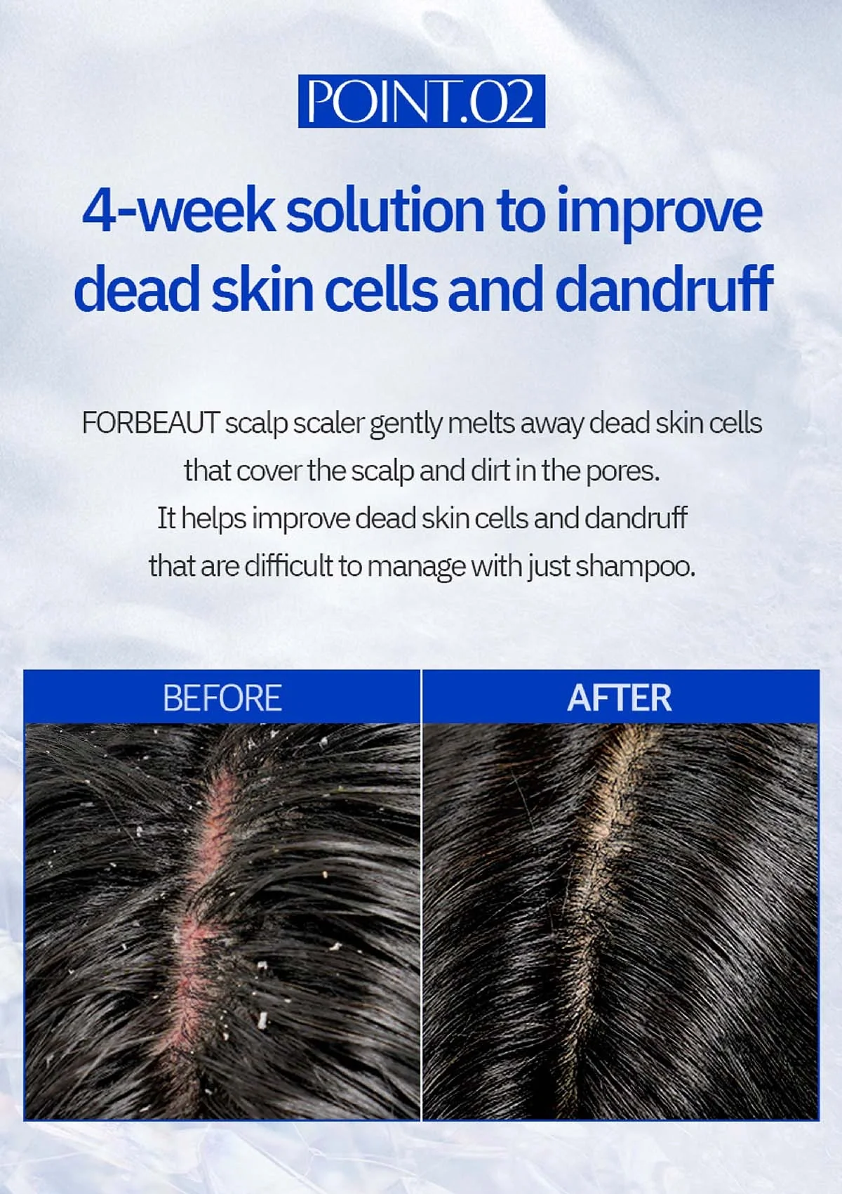 [FORBEAUT] Hyper Deep Cleansing Scalp Scaler (1 Box = 15g x 4pcs) - Image 16