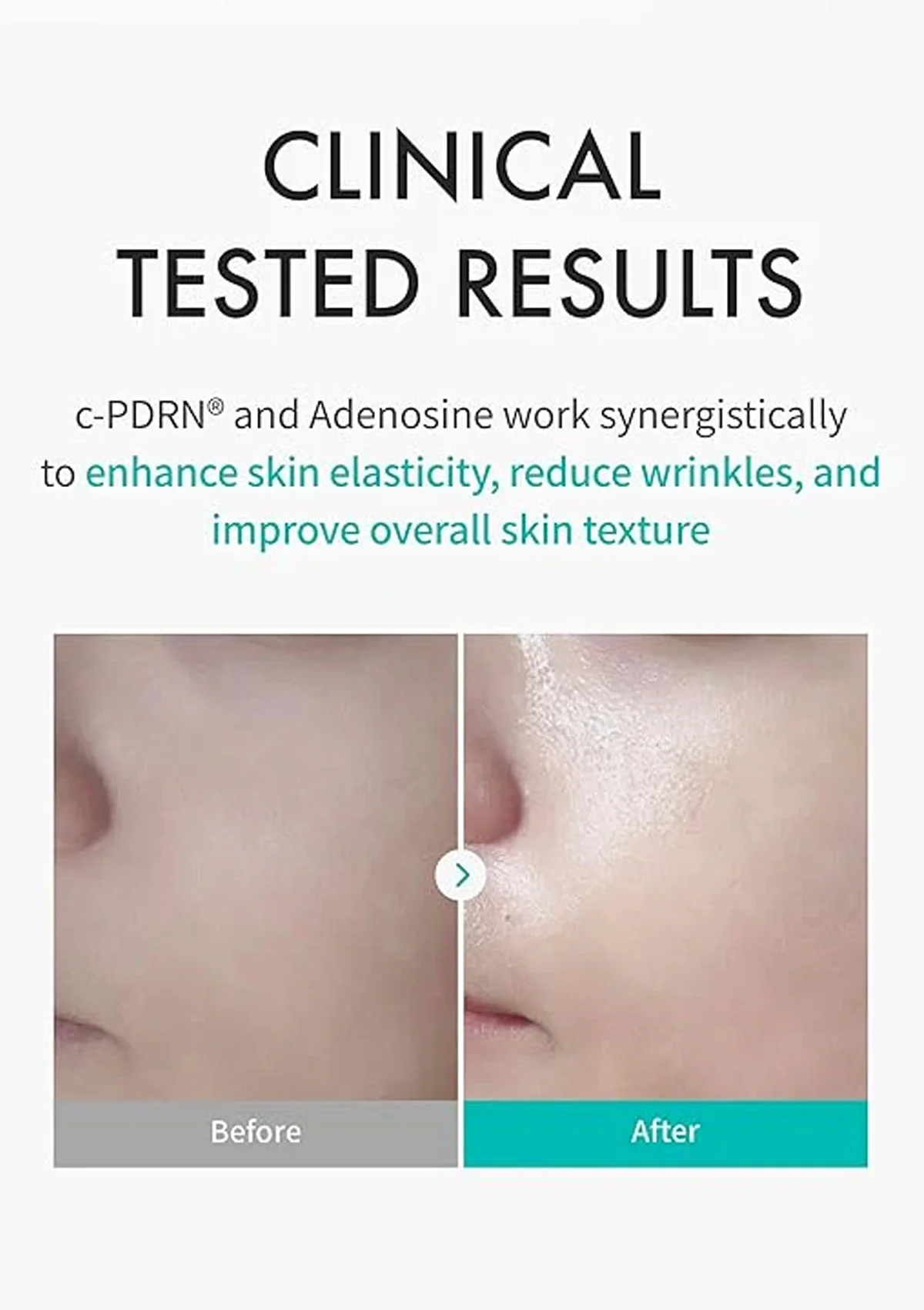 [REJURAN] Turnover Mask (1 Box = 40ml x 5 Masks) - Image 4