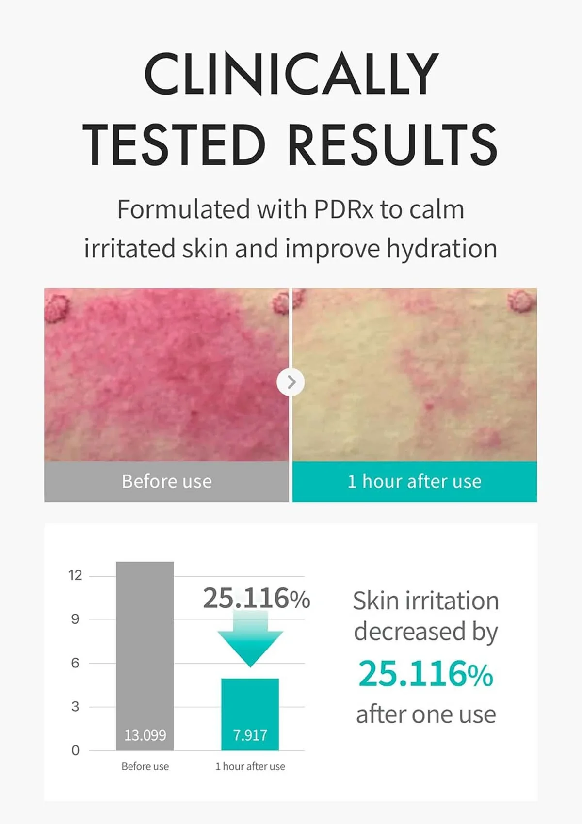 [REJURAN] Moisture Treatment Mask (1 Box = 23ml x 5 Masks) - Image 3