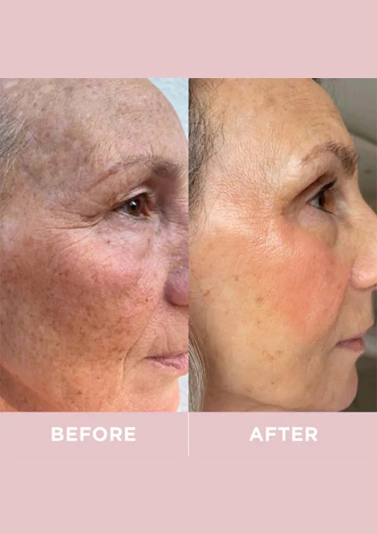 Revive Collagen Enhanced Plus - 10000mg Type I Hydrolysed Marine Collagen Drink - Image 10