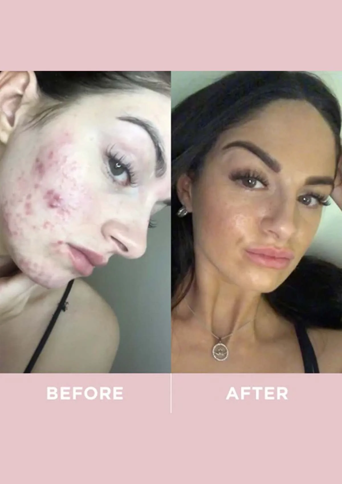 Revive Collagen Enhanced Plus - 10000mg Type I Hydrolysed Marine Collagen Drink - Image 11