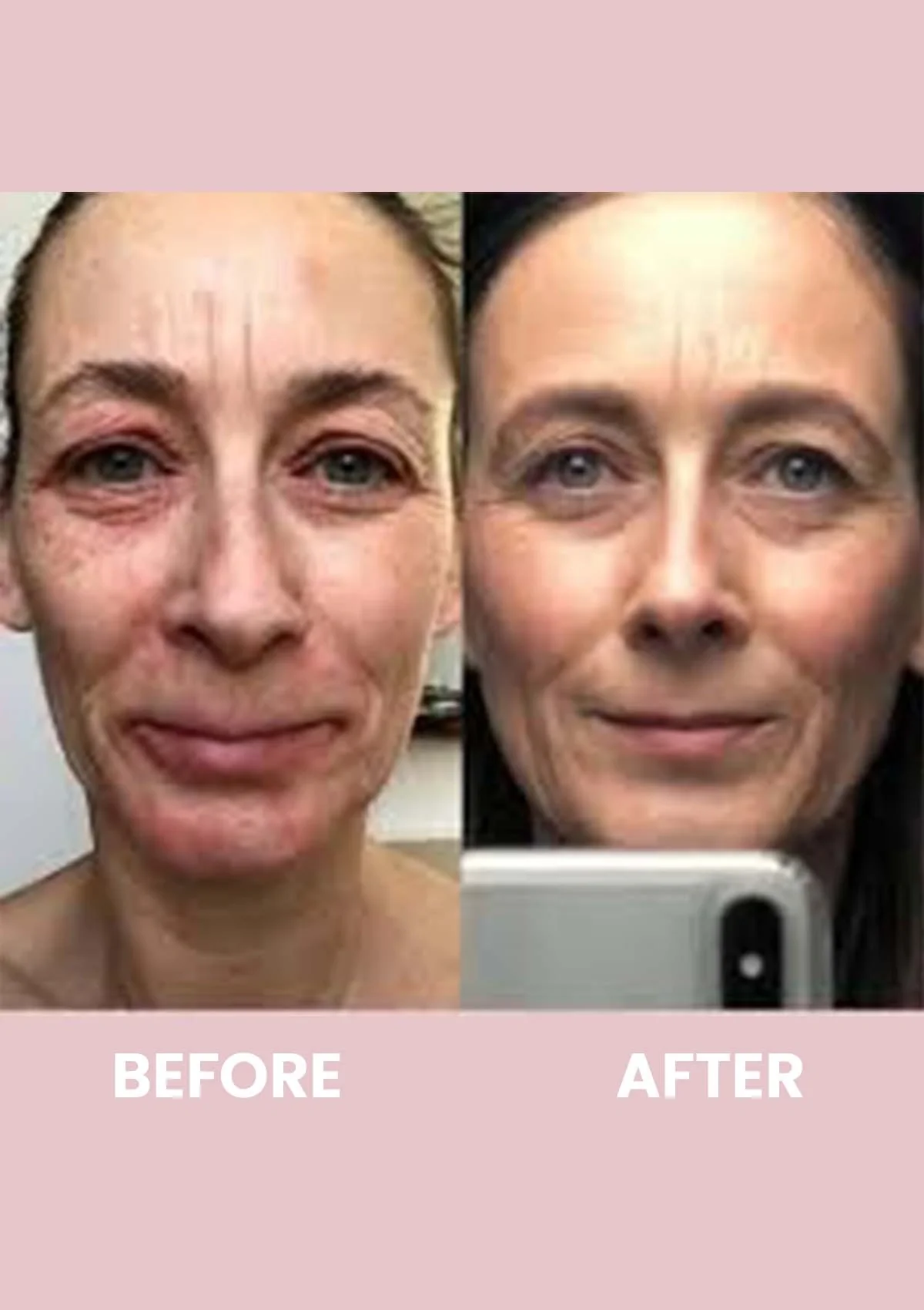 Revive Collagen Enhanced Plus - 10000mg Type I Hydrolysed Marine Collagen Drink - Image 12