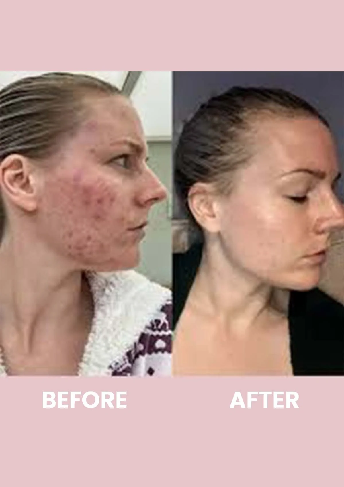 Revive Collagen Enhanced Plus - 10000mg Type I Hydrolysed Marine Collagen Drink - Image 13