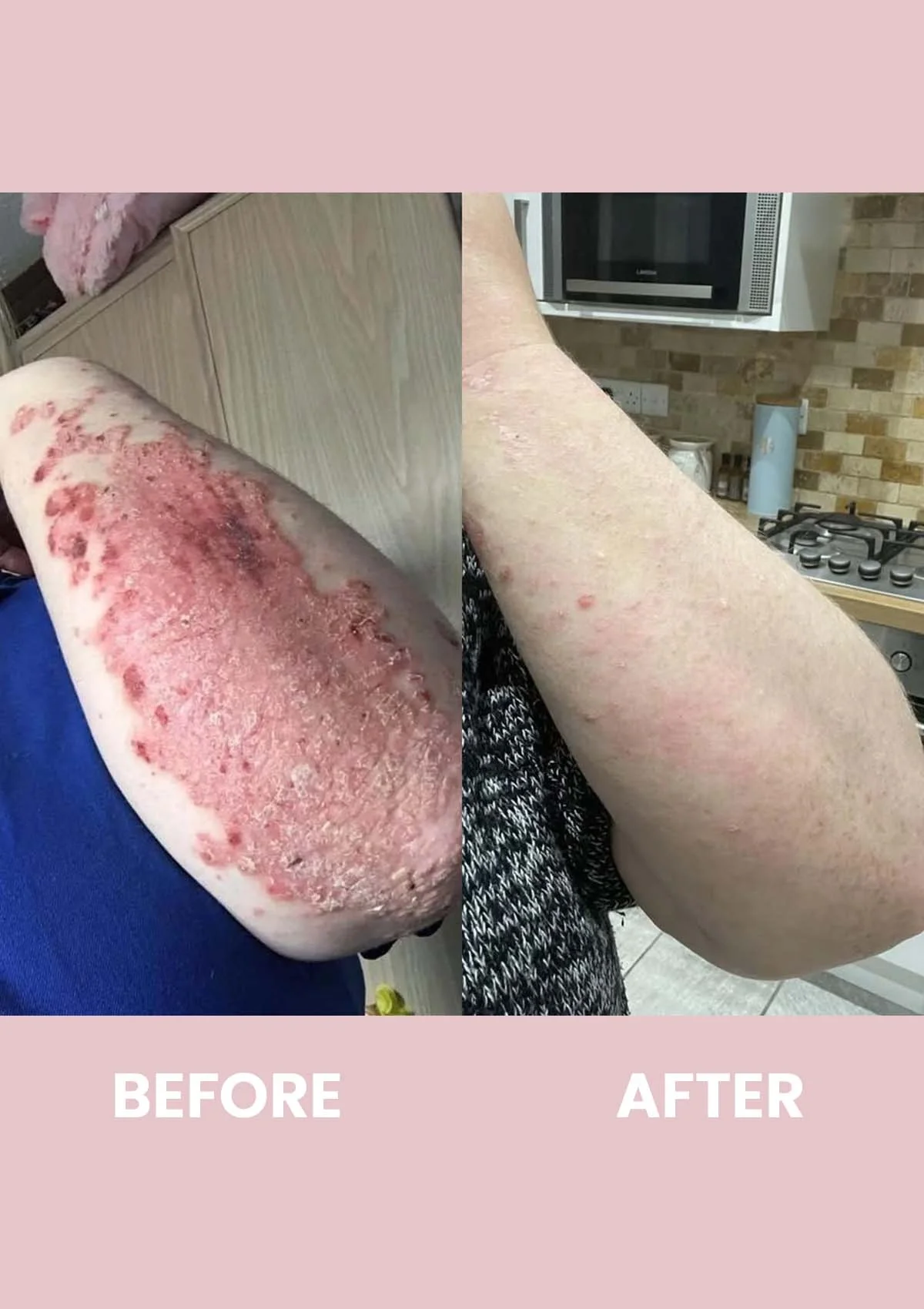 Revive Collagen Enhanced Plus - 10000mg Type I Hydrolysed Marine Collagen Drink - Image 7