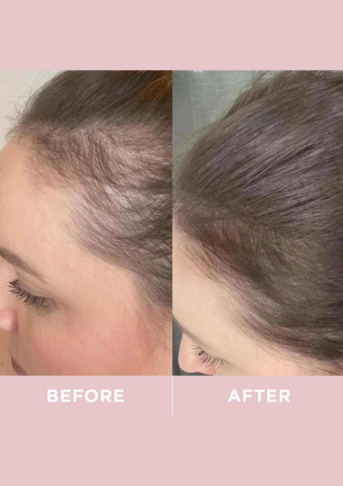 Revive Collagen Enhanced Plus - 10000mg Type I Hydrolysed Marine Collagen Drink - Image 9