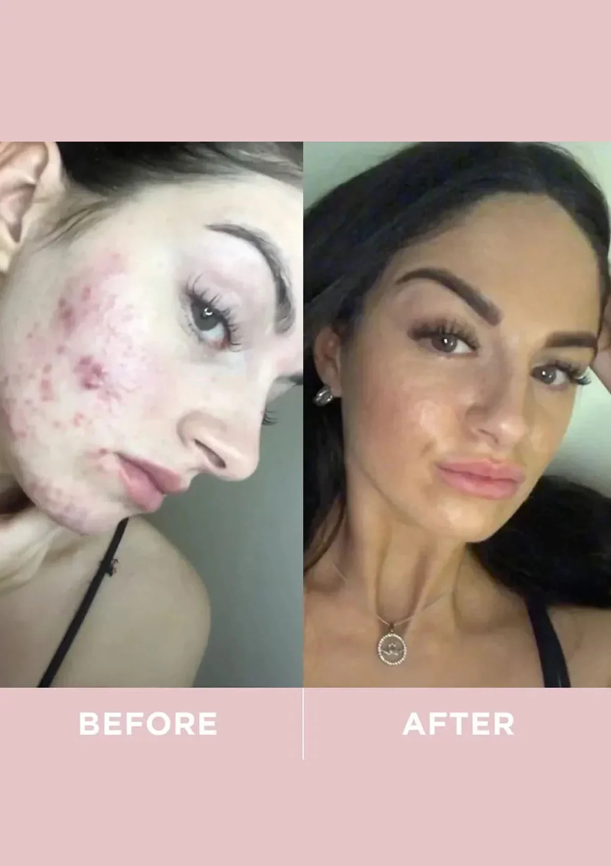 Revive Collagen Original - 8500mg Type 1  Hydrolysed Marine Collagen Drink - Image 7