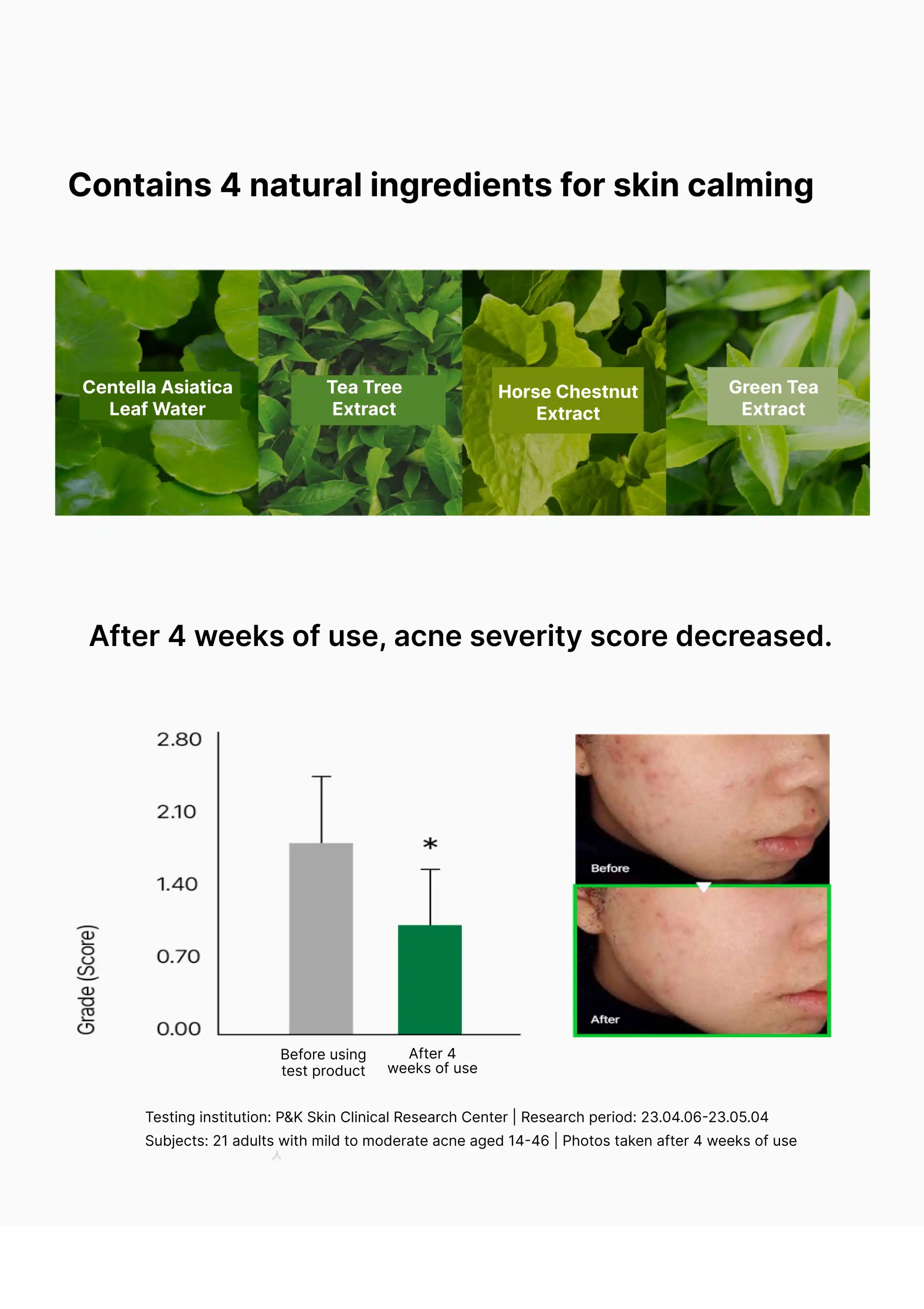 [VEMONTES] Axcne Booster Cream 25ml | 50ml - Image 16