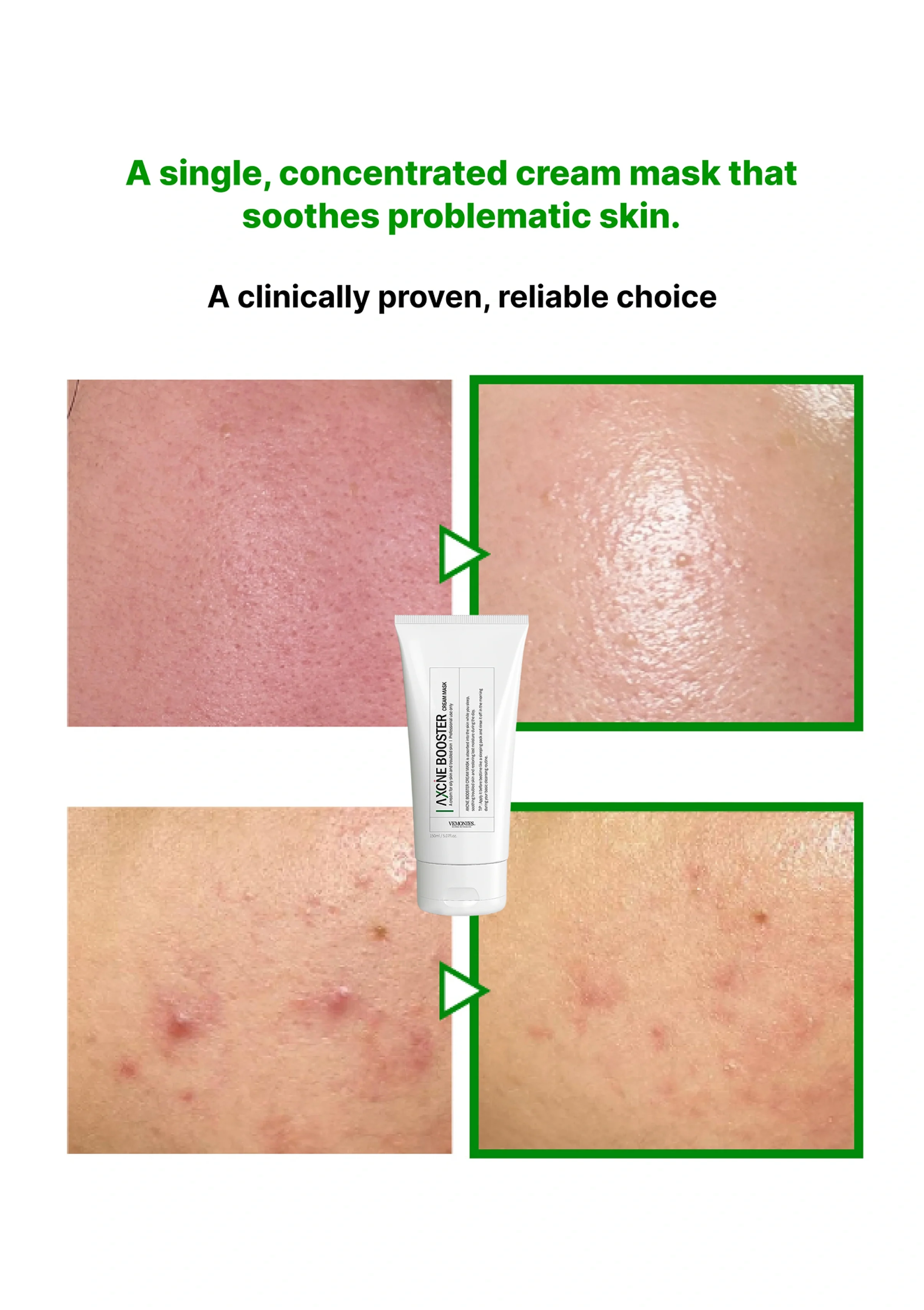 [VEMONTES] Axcne Booster Cream 50ml | Cream Mask 150ml - Image 28